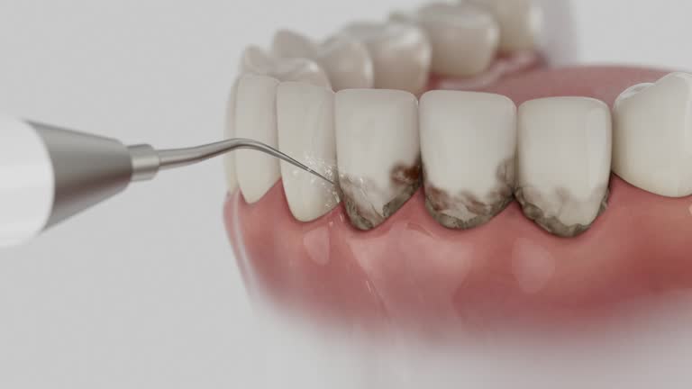 Trusted Teeth Cleaning And Checkup service in Claycomo, MO - Dentist Open Now